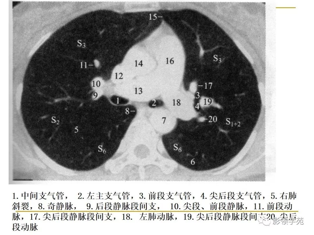 肺段与肺内管道应用解剖 肺段与肺内管道应用解剖