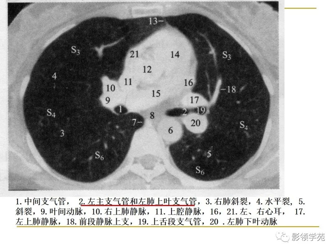 肺段与肺内管道应用解剖 肺段与肺内管道应用解剖