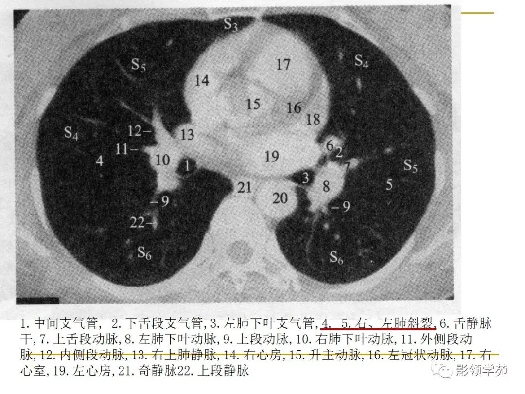 肺段与肺内管道应用解剖 肺段与肺内管道应用解剖