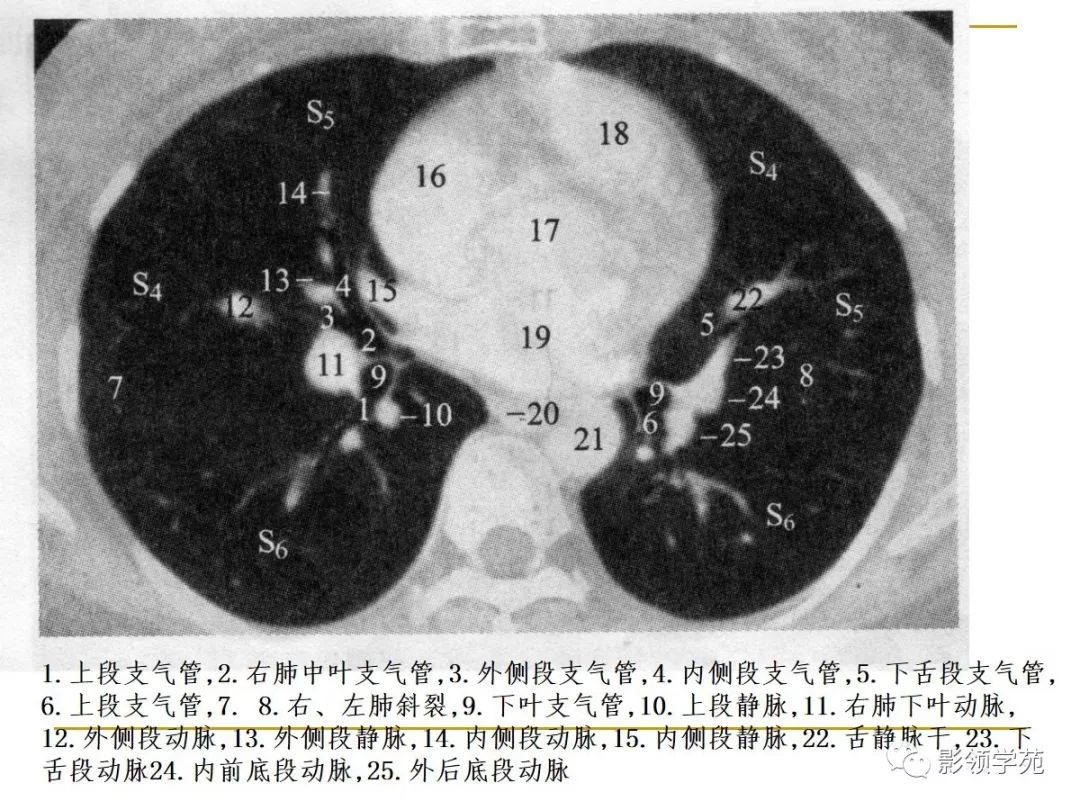 肺段与肺内管道应用解剖 肺段与肺内管道应用解剖