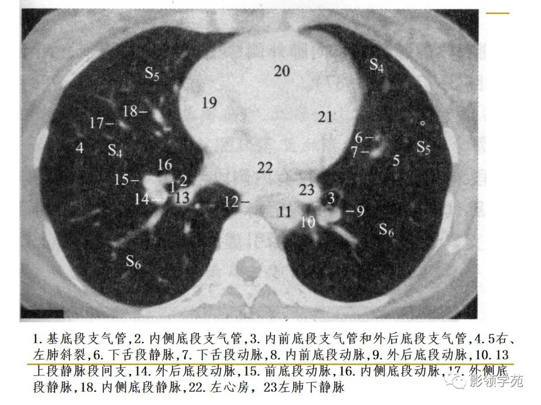 肺段与肺内管道应用解剖 肺段与肺内管道应用解剖