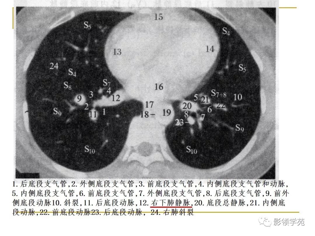 肺段与肺内管道应用解剖 肺段与肺内管道应用解剖