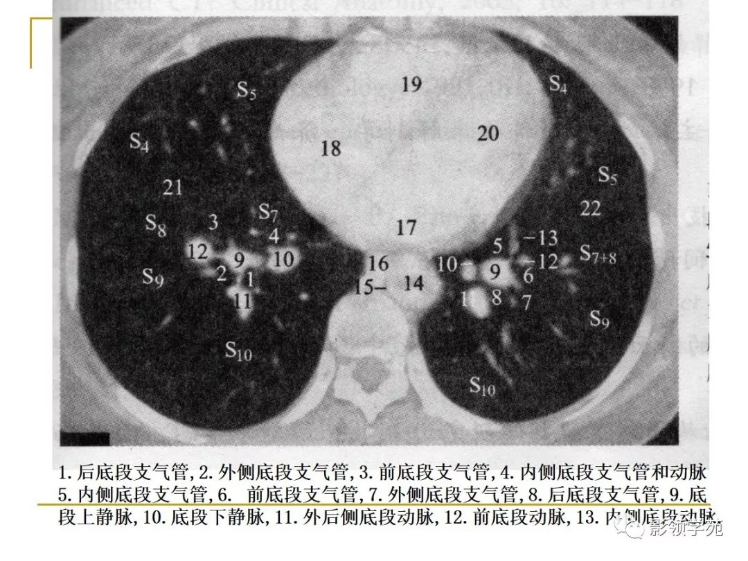 肺段与肺内管道应用解剖 肺段与肺内管道应用解剖