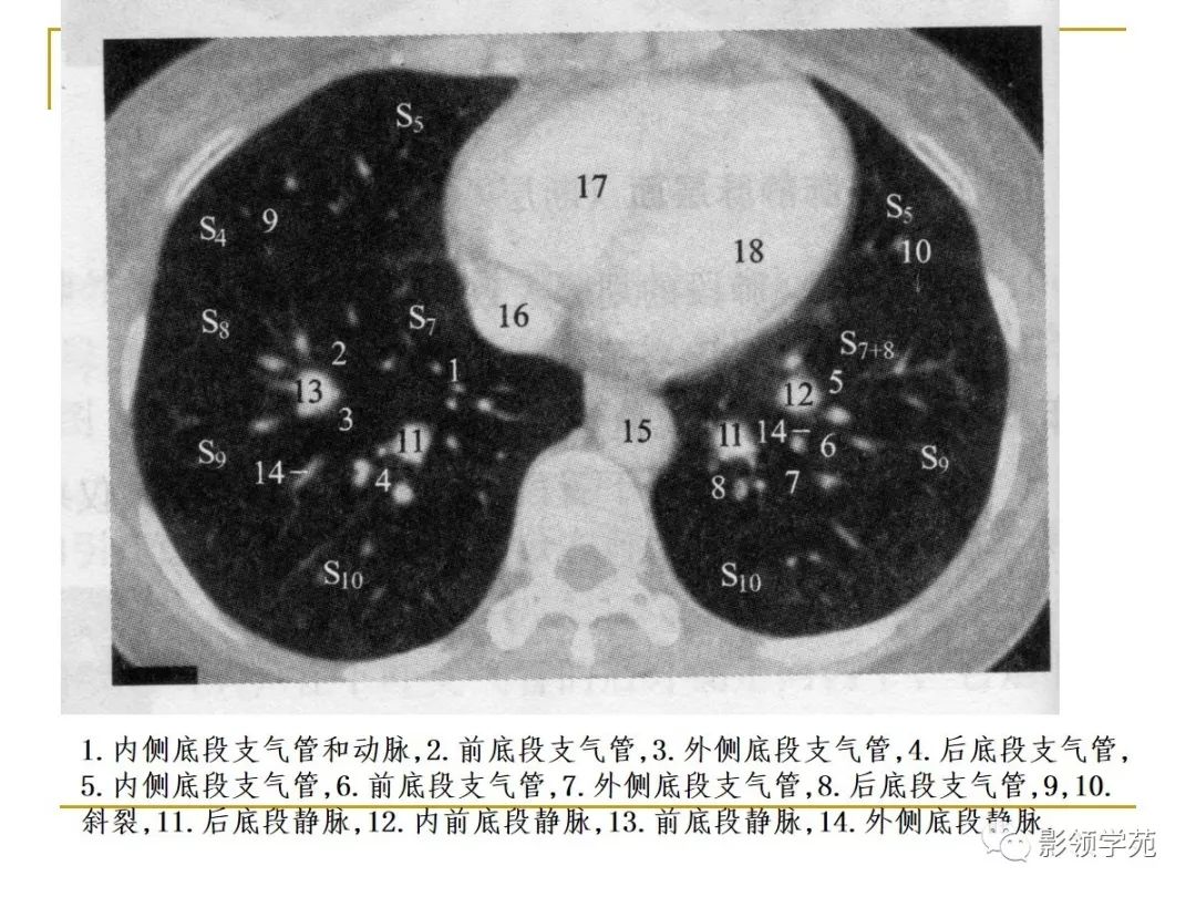 肺段与肺内管道应用解剖 肺段与肺内管道应用解剖