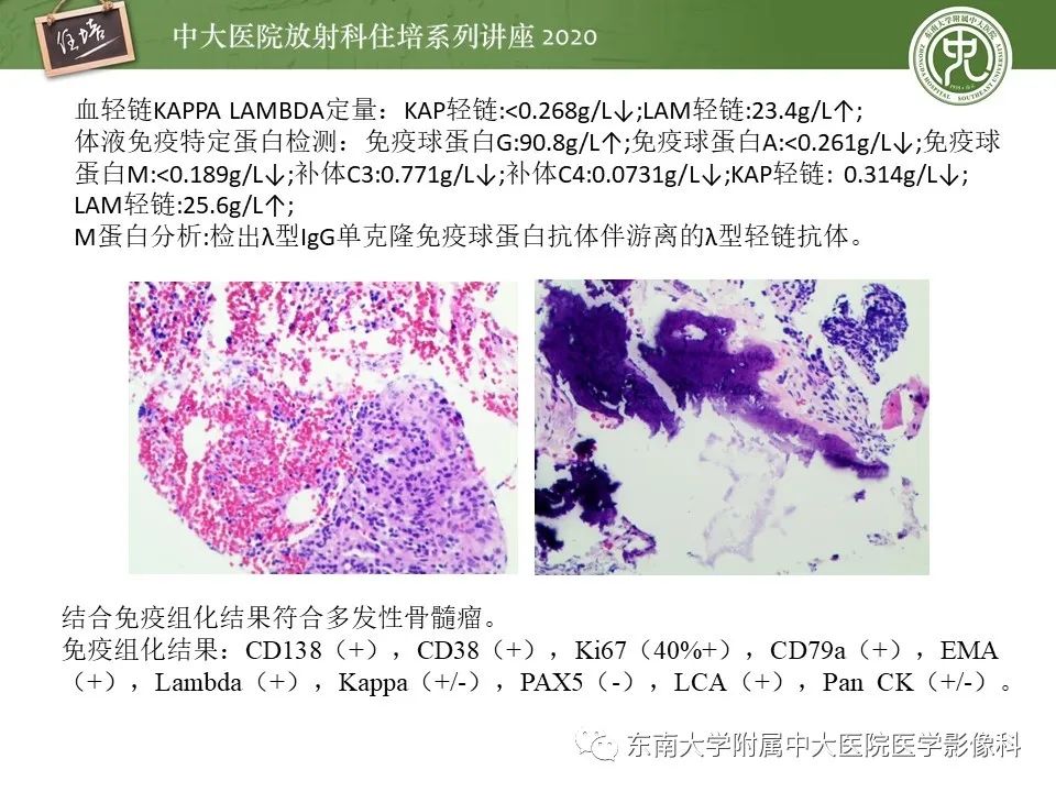 【PPT】脊柱骨源性病变影像分析思路及应用
