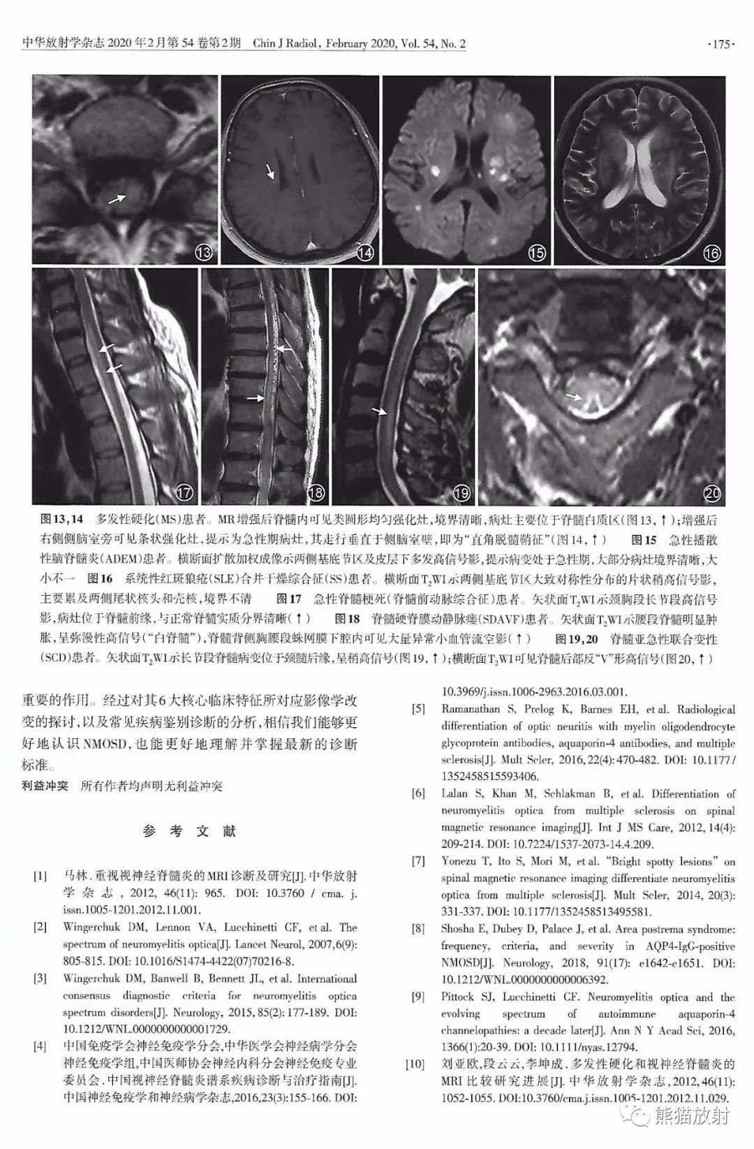 视神经脊髓炎谱系疾病的影像学诊断与鉴别诊断 视神经脊髓炎谱系疾病的影像学诊断与鉴别诊断