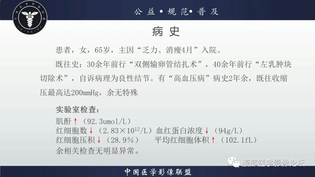 【病例】肾脏乳头状肾细胞癌1例CT及MR影像讨论 【病例】肾脏乳头状肾细胞癌1例CT及MR影像讨论