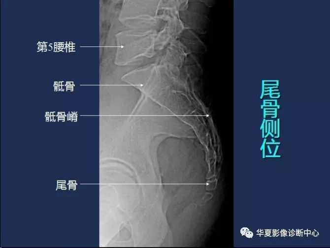 X线解剖图谱+系统解剖（骨骼篇）