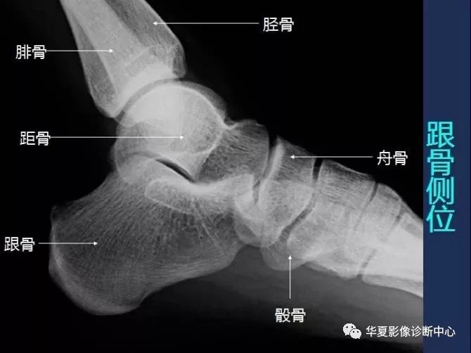 X线解剖图谱+系统解剖（骨骼篇）