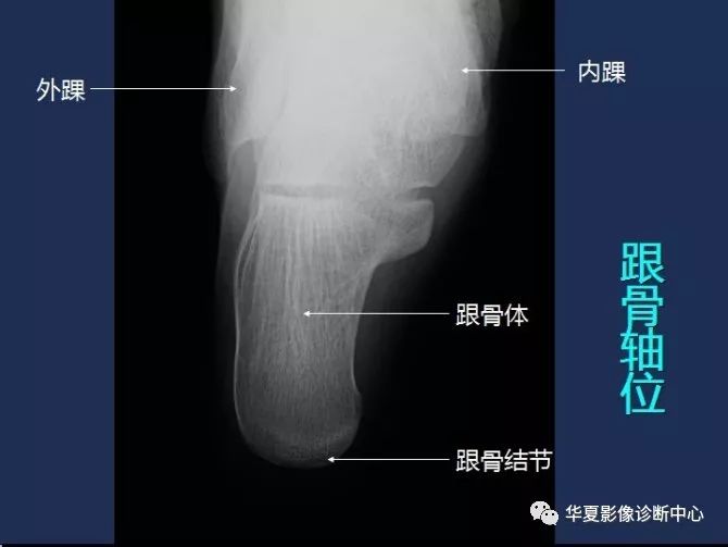 X线解剖图谱+系统解剖（骨骼篇）