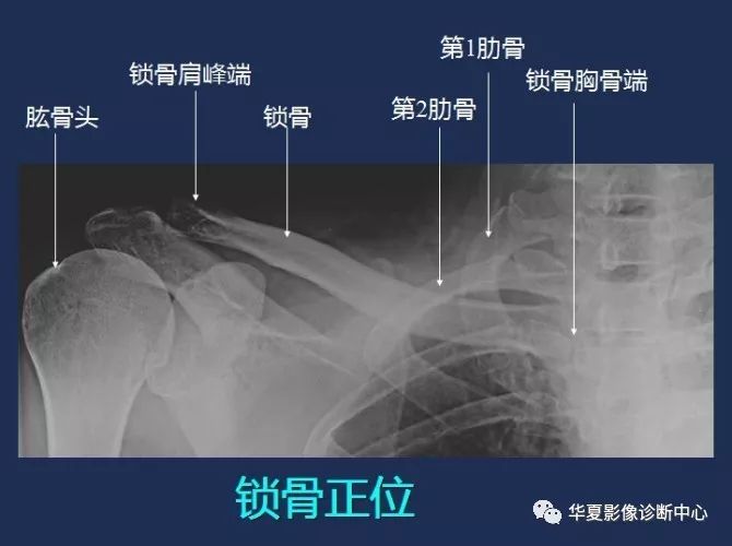 X线解剖图谱+系统解剖（骨骼篇）