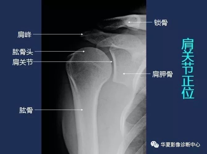 X线解剖图谱+系统解剖（骨骼篇）