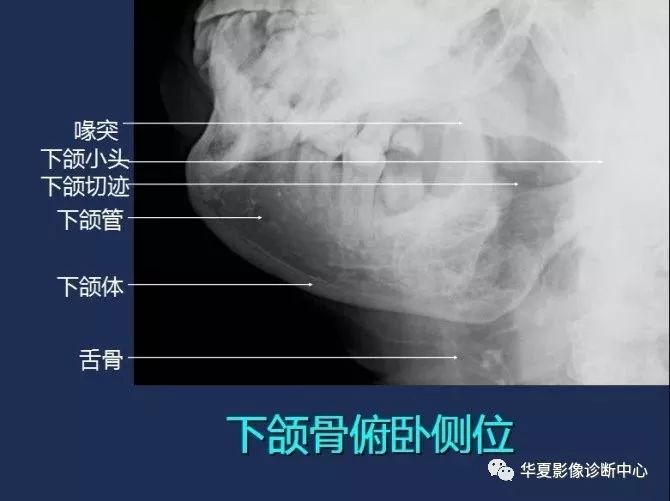 X线解剖图谱+系统解剖（骨骼篇）