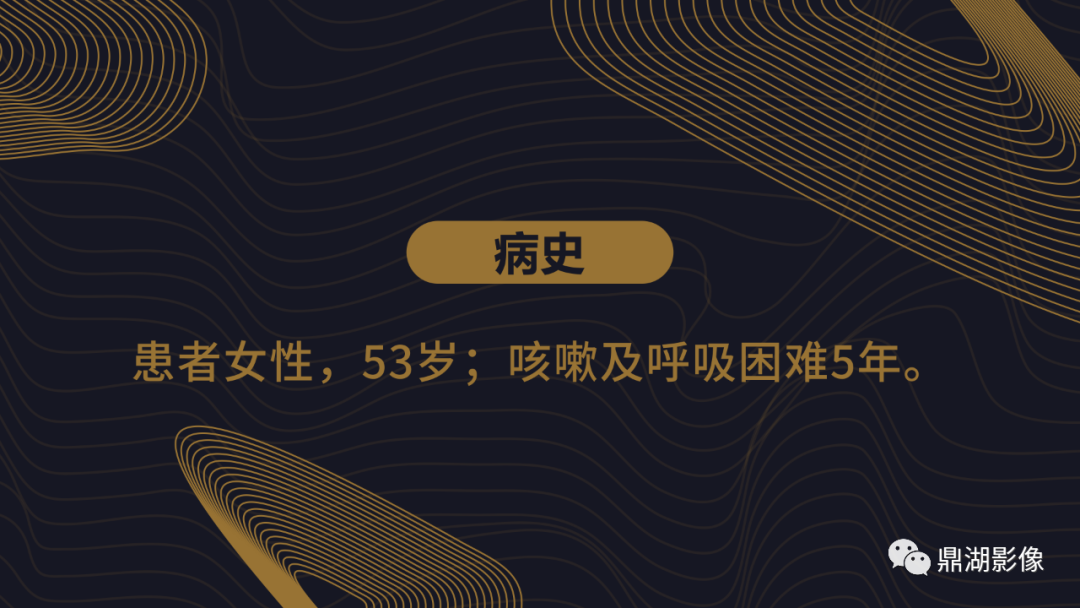 【病例】胸膜肺实质弹力纤维增生症1例CT影像 【病例】胸膜肺实质弹力纤维增生症1例CT影像