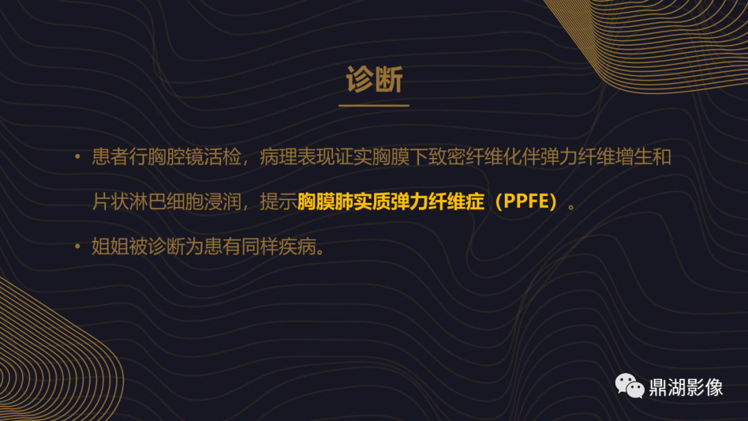 【病例】胸膜肺实质弹力纤维增生症1例CT影像 【病例】胸膜肺实质弹力纤维增生症1例CT影像