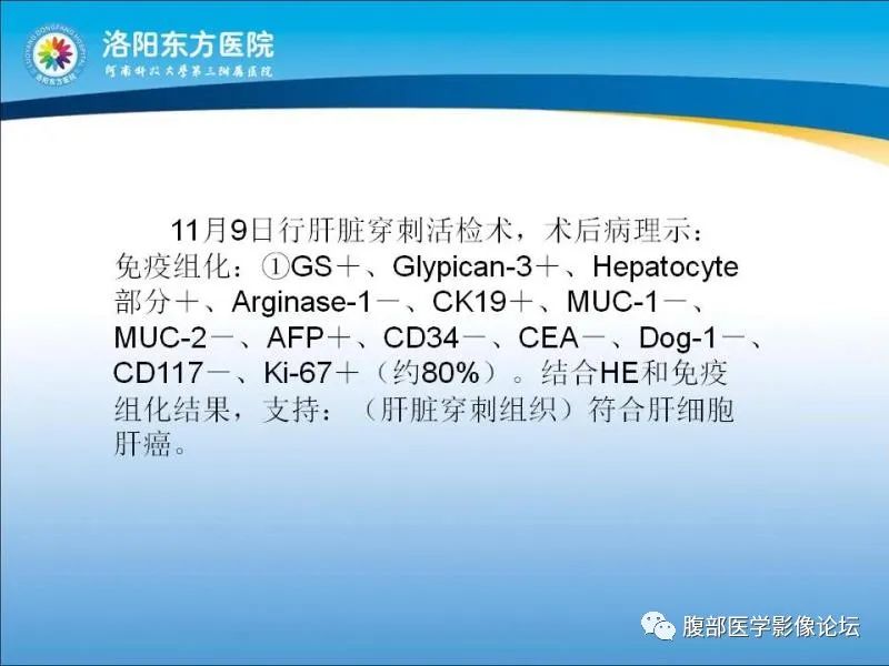 【病例】胃肝样腺癌肝内多发转移1例CT影像