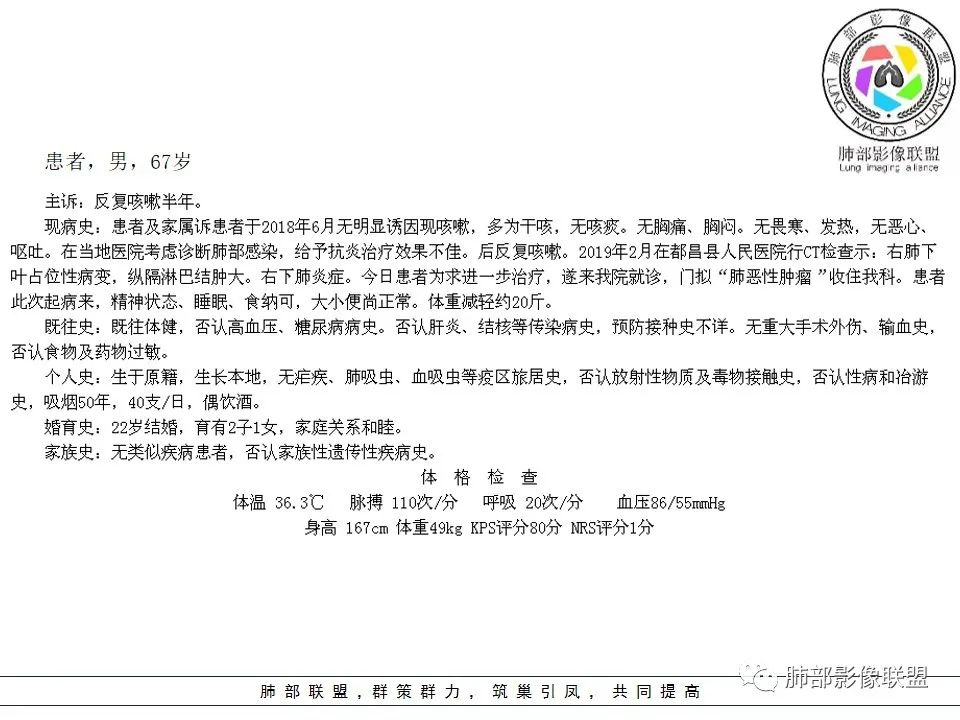 【病例】肺不典型类癌1例CT影像讨论 【病例】肺不典型类癌1例CT影像讨论
