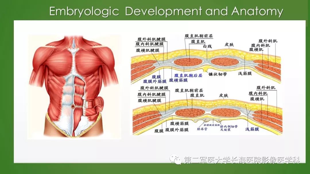 【PPT】脐尿管异常的影像表现与临床
