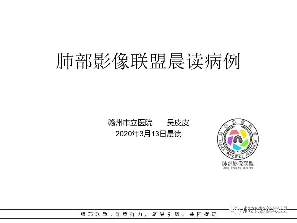 【病例】右中下肺典型类癌1例CT影像讨论 【病例】右中下肺典型类癌1例CT影像讨论