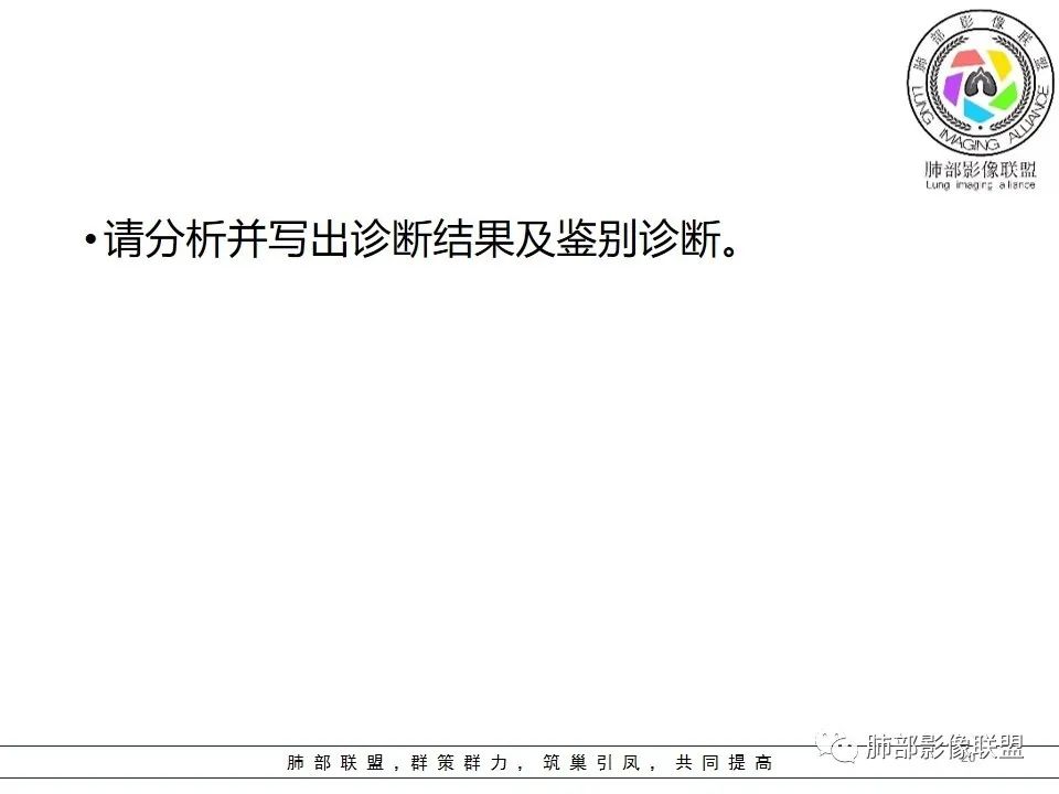 【病例】右中下肺典型类癌1例CT影像讨论 【病例】右中下肺典型类癌1例CT影像讨论