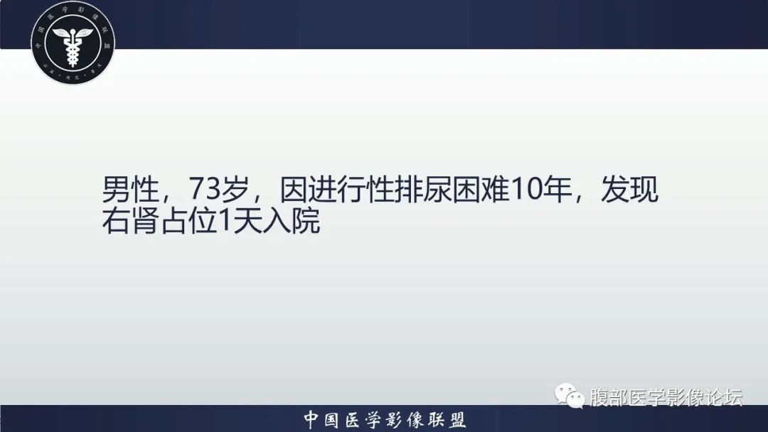【病例】右肾嗜酸细胞腺瘤1例CT影像 【病例】右肾嗜酸细胞腺瘤1例CT影像
