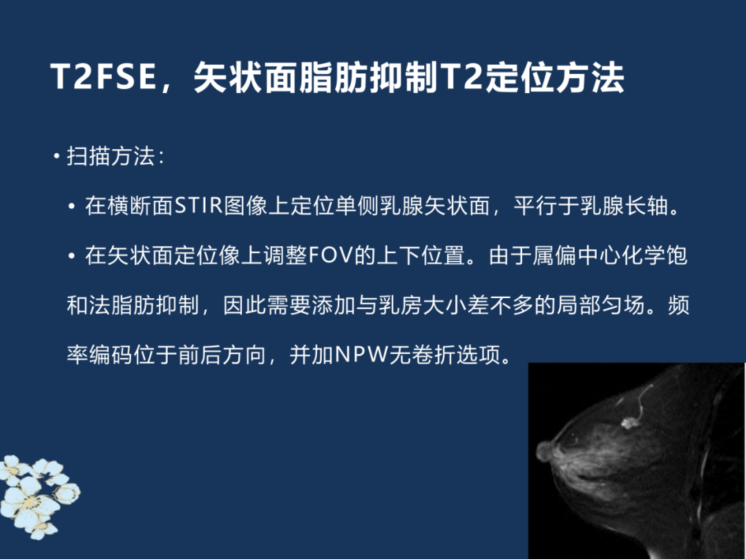 【PPT】MRI乳腺扫描技术