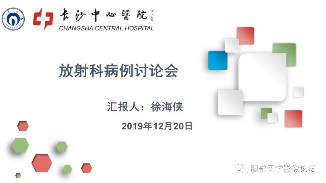 【病例】卵巢甲状腺肿1例CT影像 【病例】卵巢甲状腺肿1例CT影像