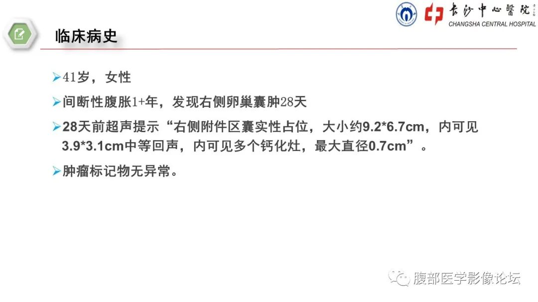 【病例】卵巢甲状腺肿1例CT影像 【病例】卵巢甲状腺肿1例CT影像