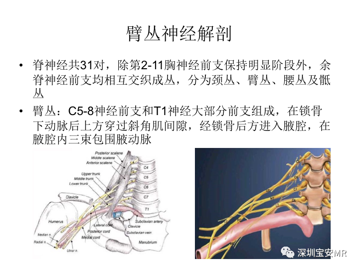 【PPT】臂丛神经MR扫描