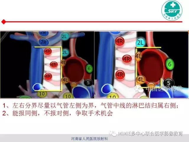 【PPT】胸部淋巴结分区及其在肺癌定性和分期诊断中的价值