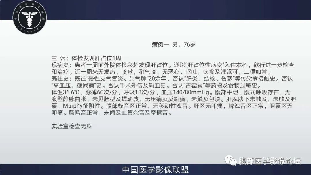 【病例】肝脏神经内分泌癌1例CT影像 【病例】肝脏神经内分泌癌1例CT影像