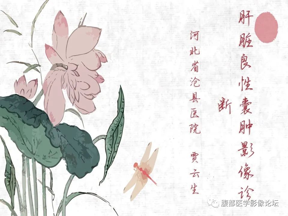 【PPT】肝脏良性囊肿影像诊断