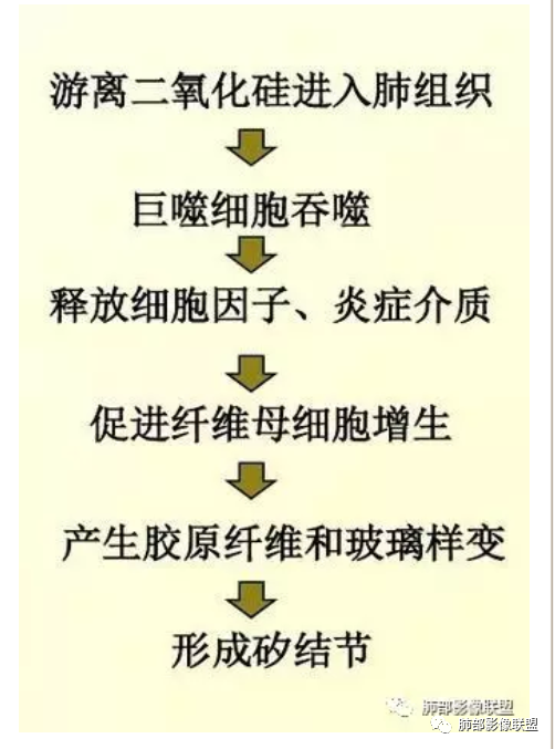 【病例】肺结核1例CT影像讨论