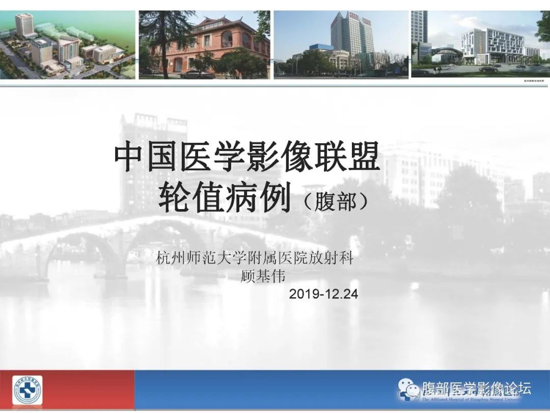 【病例】胰腺神经内分泌癌1例CT影像 【病例】胰腺神经内分泌癌1例CT影像