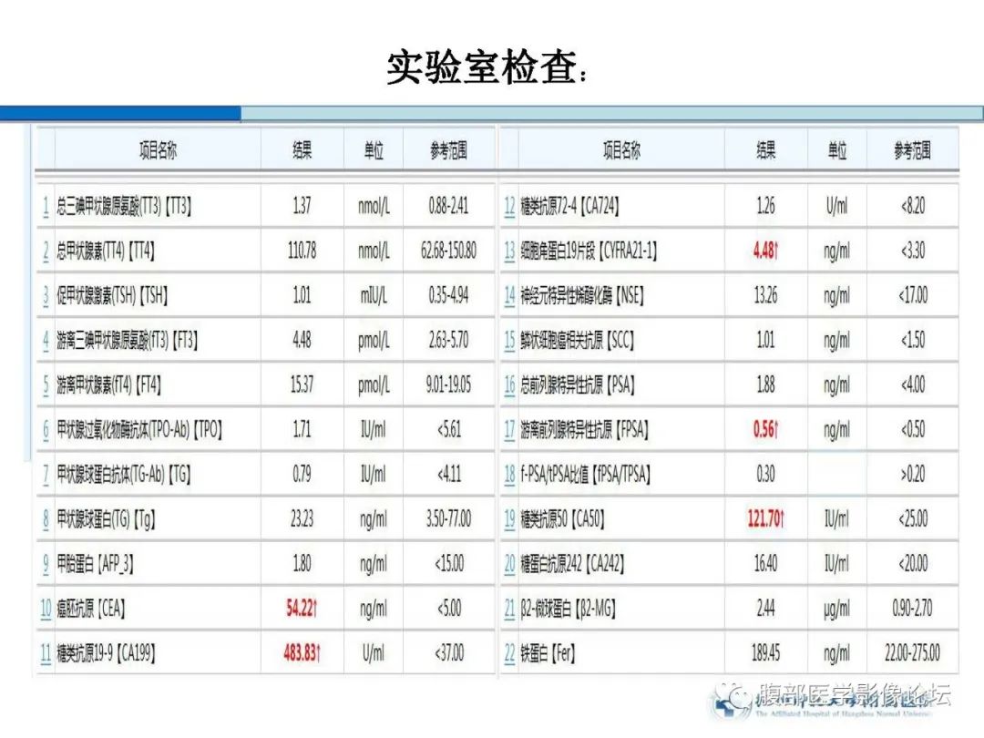 【病例】胰腺神经内分泌癌1例CT影像 【病例】胰腺神经内分泌癌1例CT影像