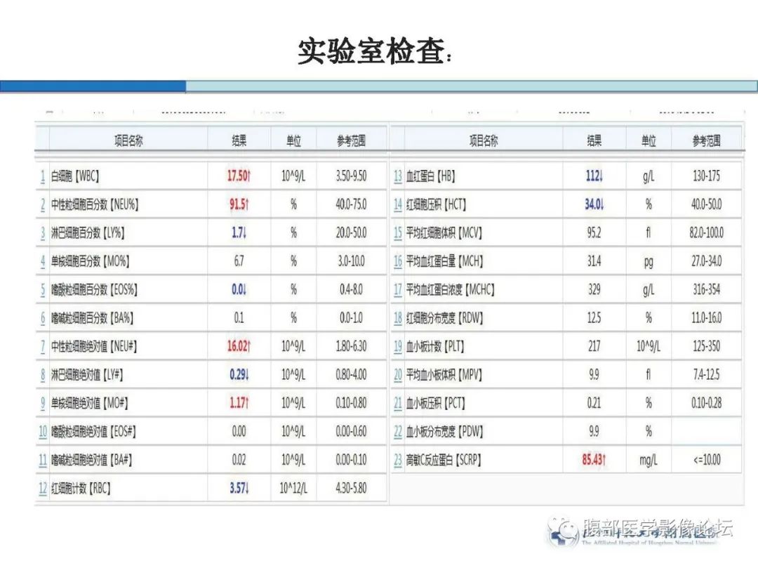 【病例】胰腺神经内分泌癌1例CT影像 【病例】胰腺神经内分泌癌1例CT影像