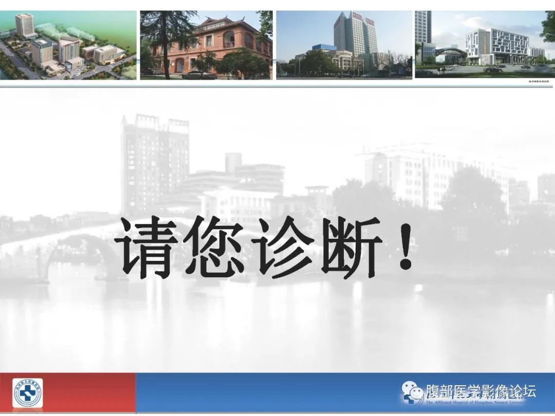 【病例】胰腺神经内分泌癌1例CT影像 【病例】胰腺神经内分泌癌1例CT影像