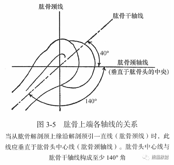 骨关节画线及测量 骨关节画线及测量