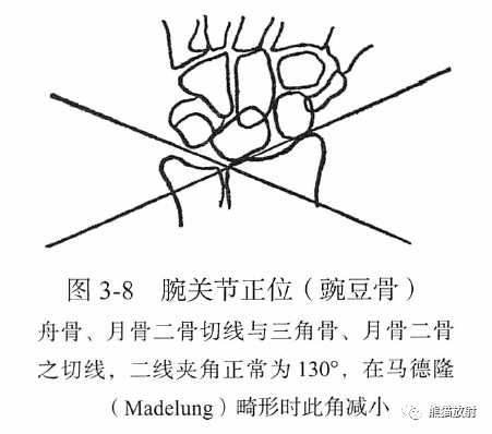 骨关节画线及测量 骨关节画线及测量