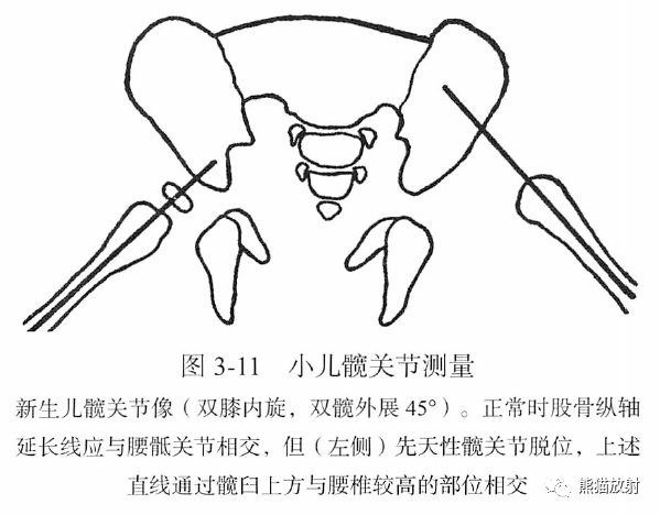 骨关节画线及测量 骨关节画线及测量