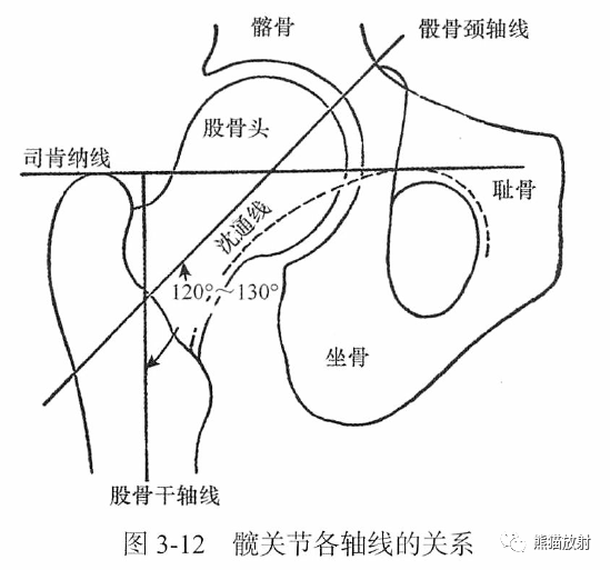 骨关节画线及测量 骨关节画线及测量