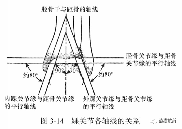 骨关节画线及测量 骨关节画线及测量