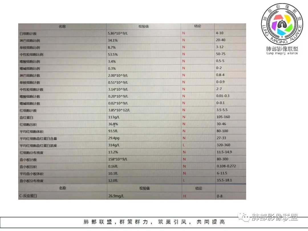 【病例】小征象大用途---脐凹征 【病例】小征象大用途---脐凹征