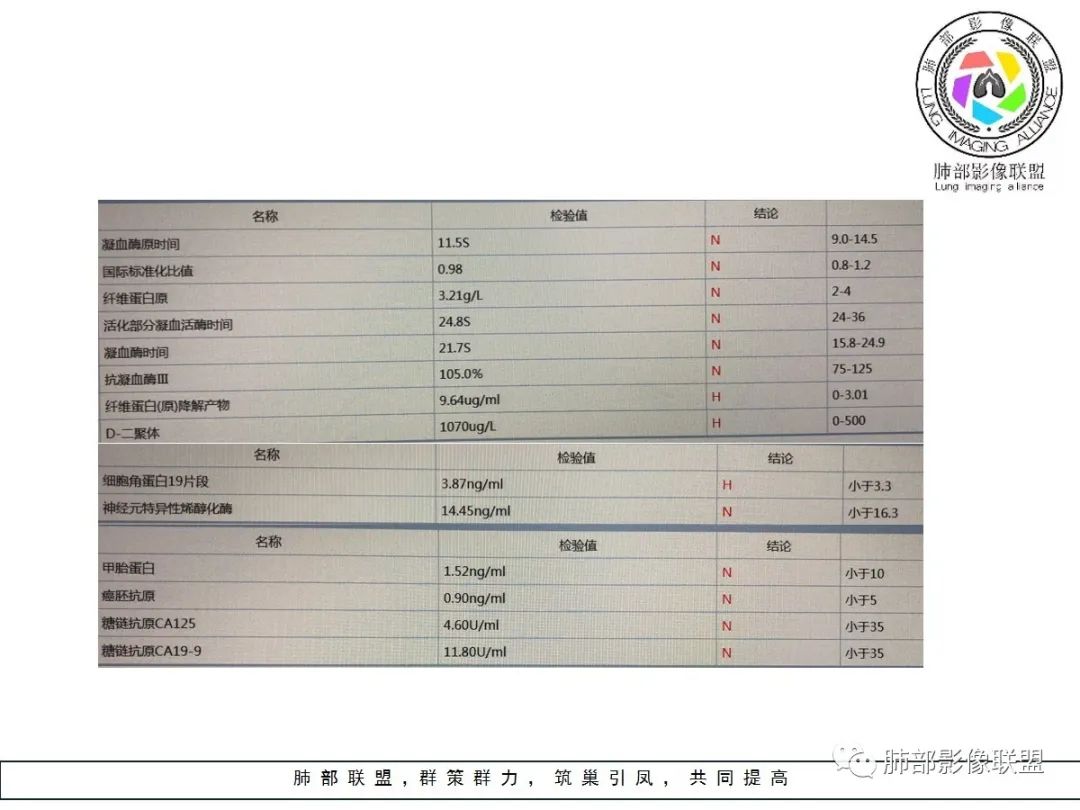 【病例】小征象大用途---脐凹征 【病例】小征象大用途---脐凹征