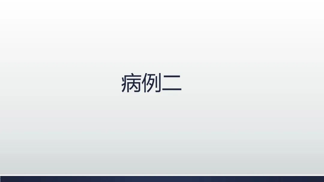 【病例】阑尾低级别粘液性肿瘤1例CT影像 【病例】阑尾低级别粘液性肿瘤1例CT影像