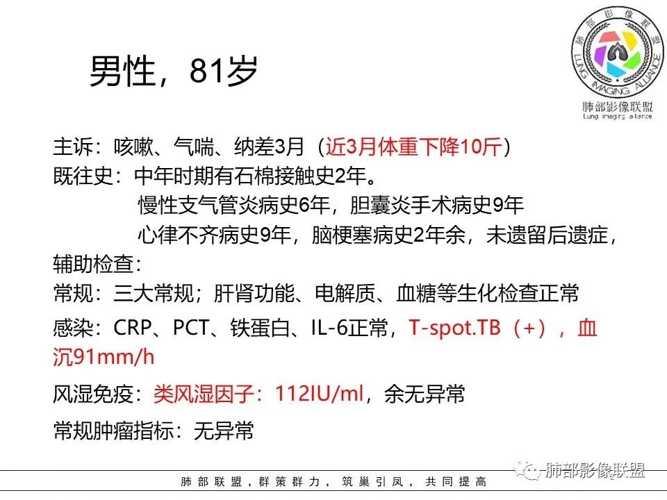 【病例】三明治征”之谜—胸膜淋巴瘤1例CT影像 【病例】三明治征”之谜—胸膜淋巴瘤1例CT影像