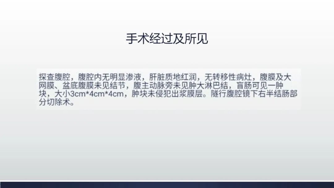 【病例】肠壁海绵状淋巴管瘤伴套叠1例CT 【病例】肠壁海绵状淋巴管瘤伴套叠1例CT