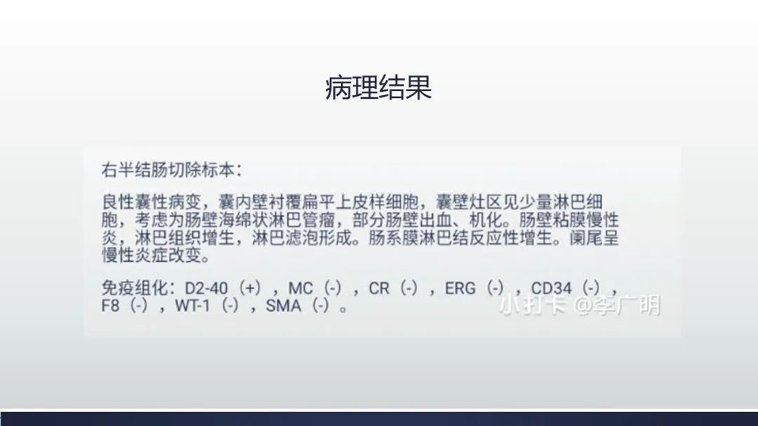 【病例】肠壁海绵状淋巴管瘤伴套叠1例CT 【病例】肠壁海绵状淋巴管瘤伴套叠1例CT