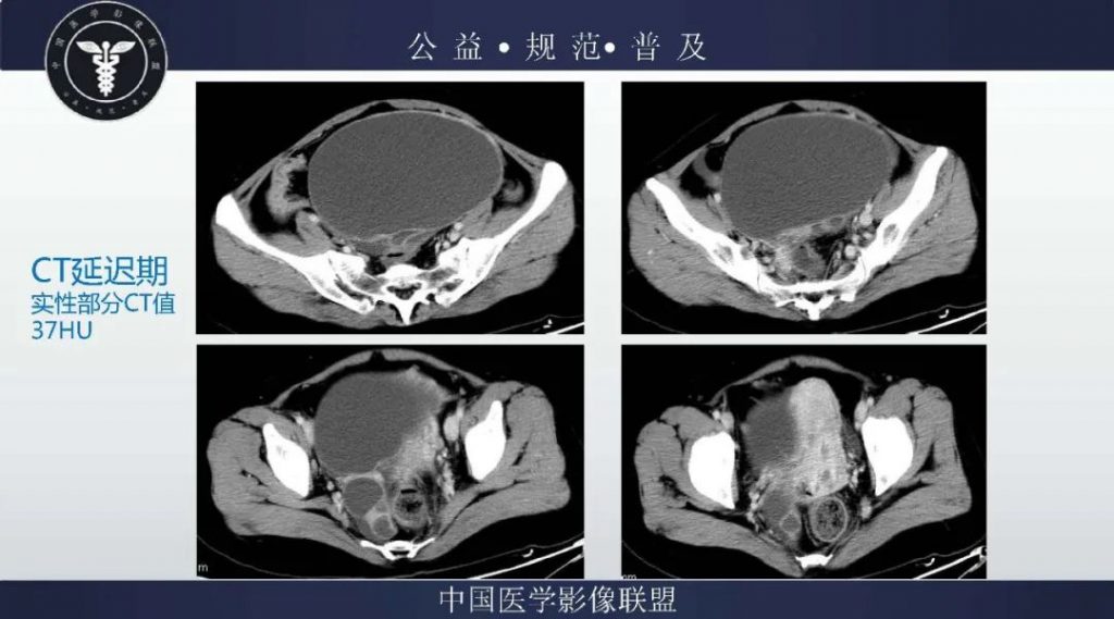 自动草稿