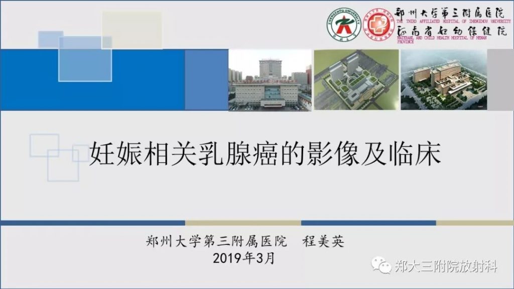 【PPT】妊娠相关乳腺癌的影像诊断
